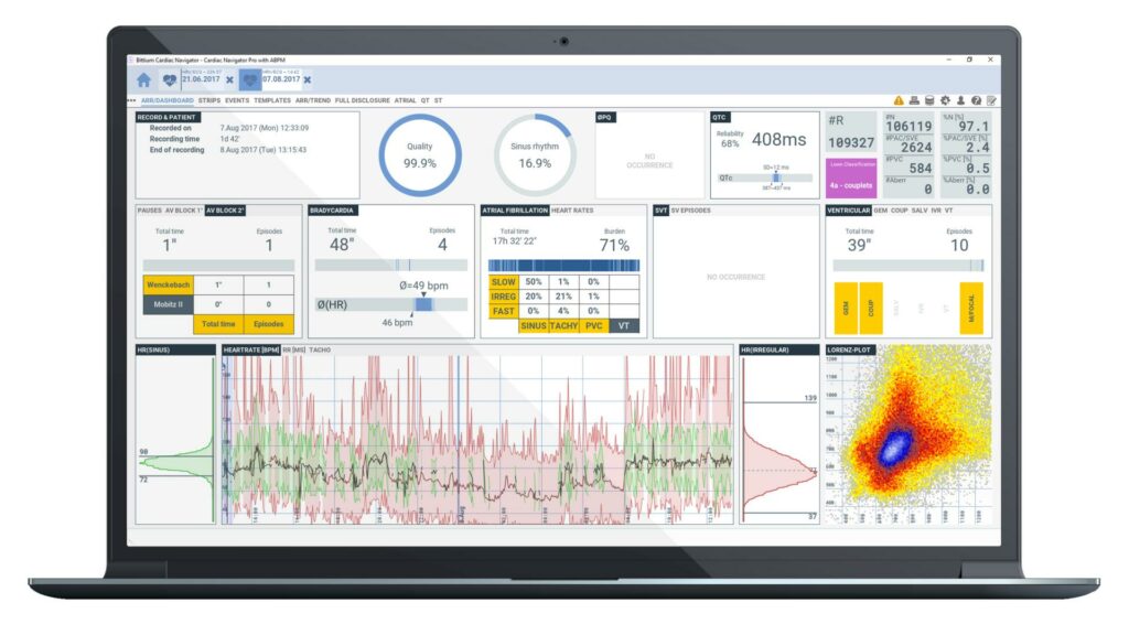 Bittium Cardiac Navigator Analysis Software