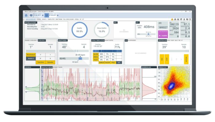 Bittium Cardiac Navigator Analysis Software