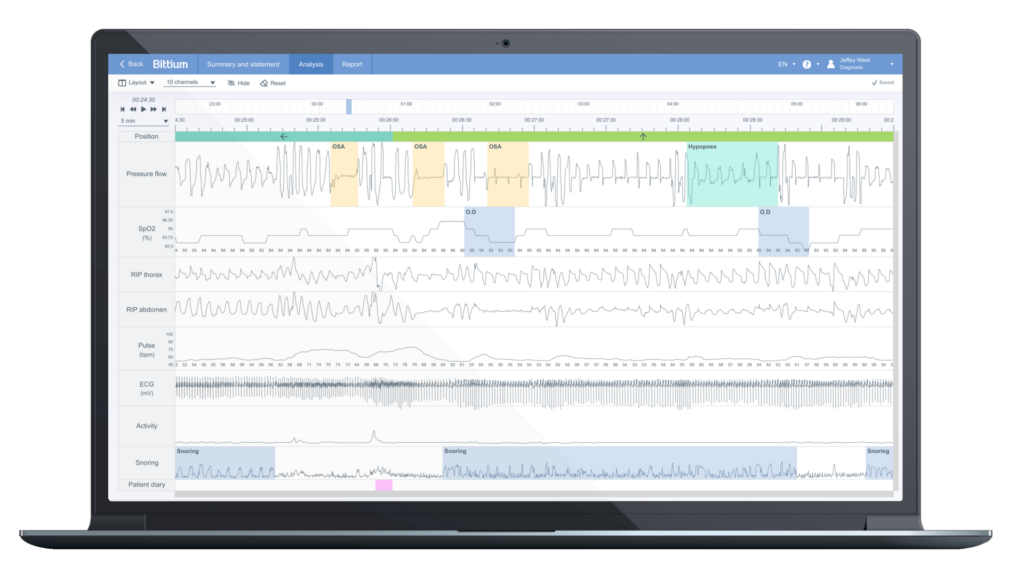 Fast and Efficient Sleep Apnea Analysis with Bittium Respiro Analyst™ Software