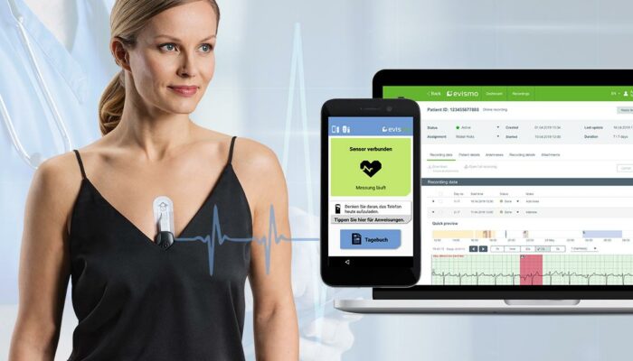 Woman wearing a wireless ECG monitoring device, with a smartphone and laptop displaying real-time heart data.