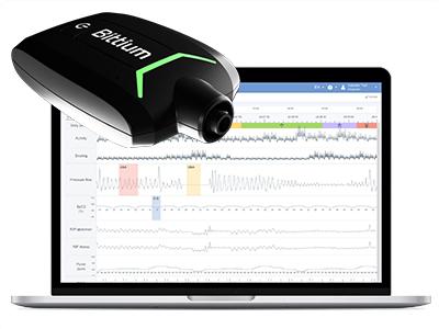 Sleep apnea monitoring